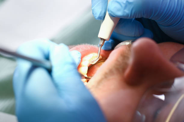 Best Urgent Care for Lost Fillings or Crowns in Iron River, MI