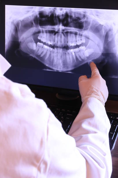 Best Emergency Treatment for Dental Infections or Abscesses in Iron River, MI