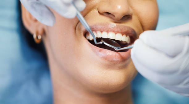 Best Emergency Root Canal Treatment in Iron River, MI